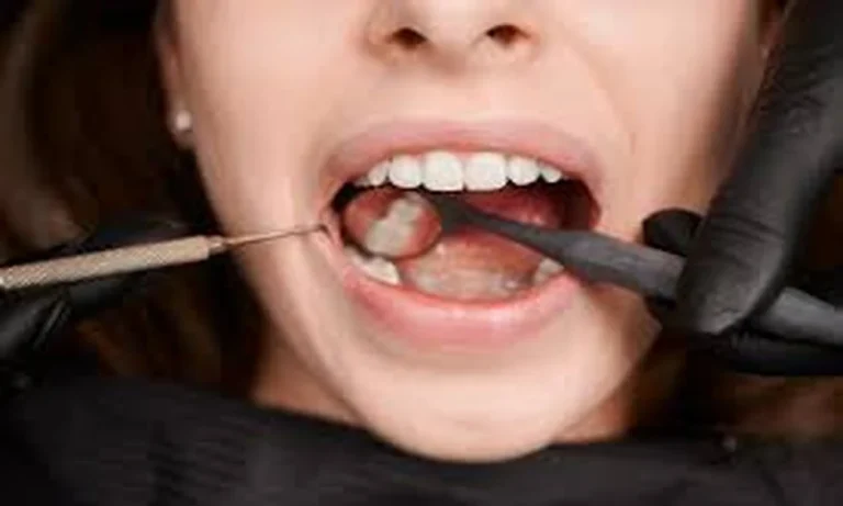 Restoring Comfort Quickly Through Emergency Dental Treatment